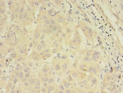 Polyclonal Rabbit anti-Human ABCB5 Antibody (IHC)