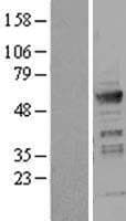 ICA69 / ICA1 Protein (Over-Expression Lysate Myc-DDK (Flag))
