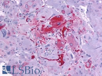 PathPlus™ P2RY14 / GPR105 Antibody (C-Terminus)