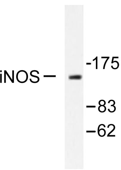NOS2 / iNOS Antibody (Val1131)