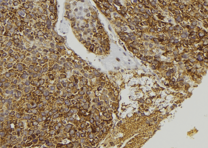 CCL23 / MIP3 Antibody