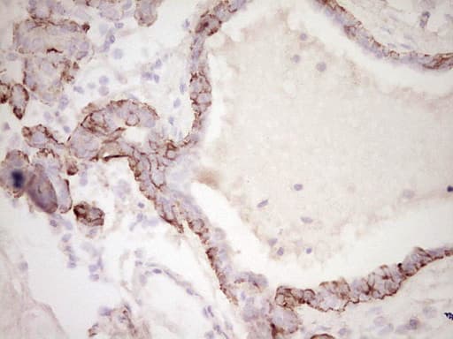 DMN / Desmuslin / Synemin Antibody (aa329-580, clone OTI5G1)