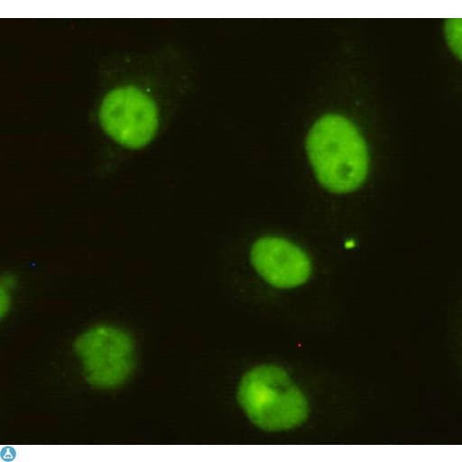 Monoclonal Mouse anti-Human BRINP1 / DBC1 Antibody (WB)