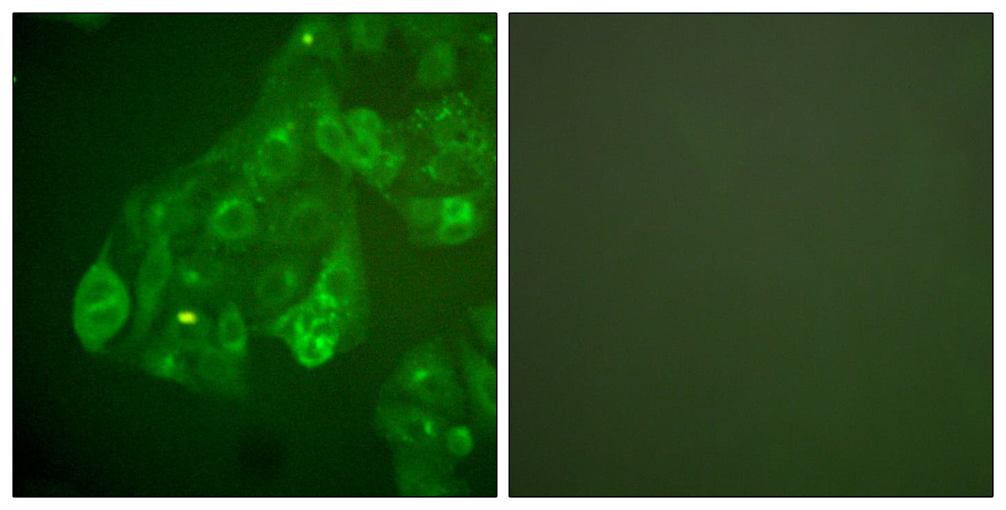 IHC-plus™ Polyclonal Rabbit anti-Human GJA1 / CX43 / Connexin 43 Antibody (aa333-382, IHC, IF, WB)