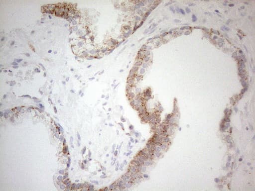Monoclonal Mouse anti-Human NAPSA / NAPA / Napsin A Antibody (clone OTI3C6, aa64-244, IHC)