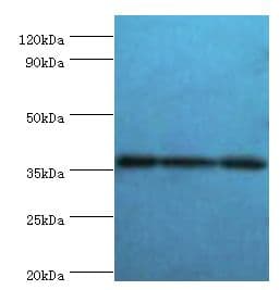 SLAMF7 / CRACC Antibody (aa23-226)