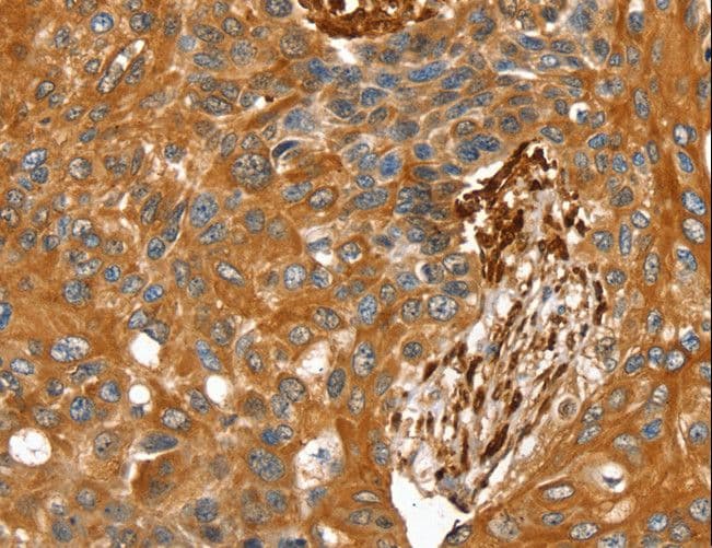 TAGLN / Transgelin / SM22 Antibody