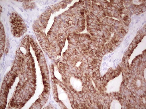 ABCB1 / MDR1 / P Glycoprotein Antibody (aa995-1280, clone OTI8A9, Carrier-free)