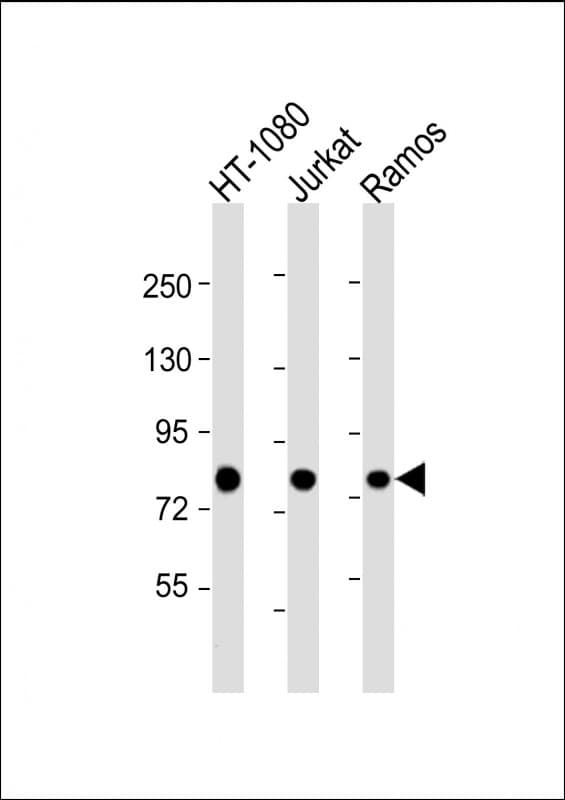 Monoclonal Mouse anti-Human GARS / Glycyl tRNA Synthetase Antibody (clone 1641CT837.23.96, aa15-305, WB)