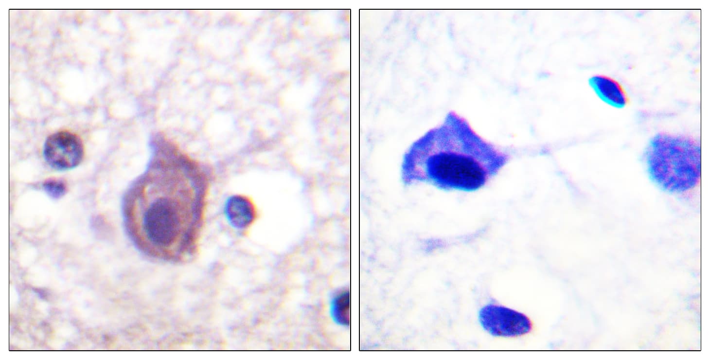 CD4 Antibody (phospho-Ser433)