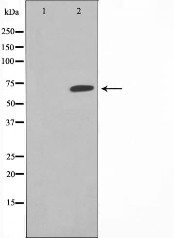 F2 / Prothrombin / Thrombin Antibody