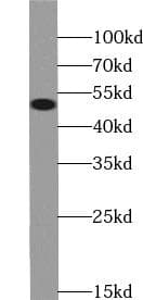 NAMPT / Visfatin Antibody