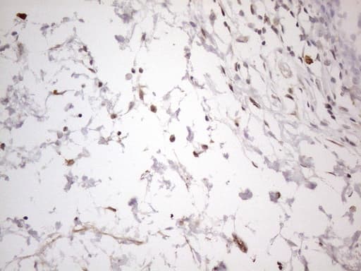 Monoclonal Mouse anti-Human SNRPB2 Antibody (clone OTI2A5, IHC, WB)