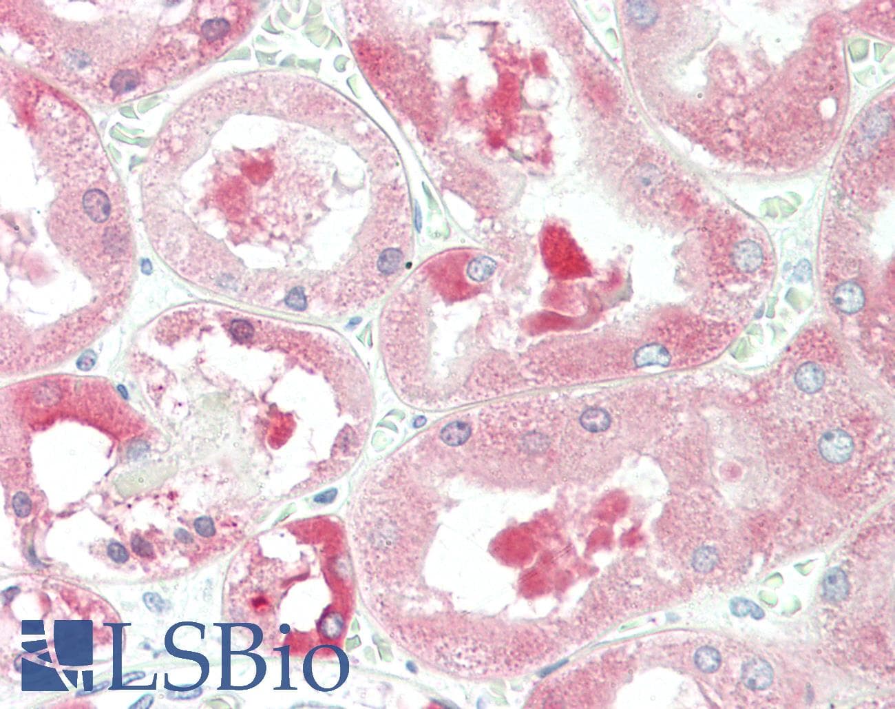 IHC-plus™ ALDH1L1 Antibody
