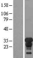Human XPA Protein (Over-Expression Lysate Myc-DDK (Flag))