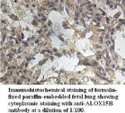 TGFB1 / TGF Beta 1 Antibody