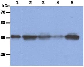 PathPlus™ NPM1 / NPM / Nucleophosmin Antibody (clone AT23F1)