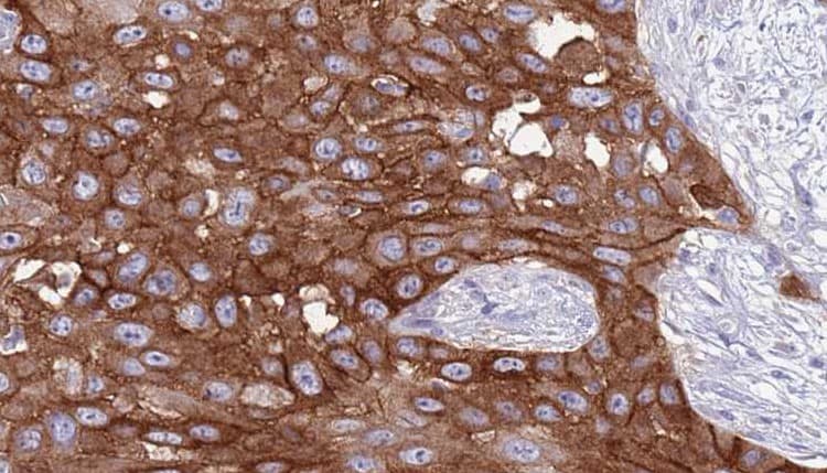 CD247 / CD3 Zeta Antibody