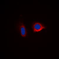 CASP6 / Caspase 6 Antibody (C-Terminus)