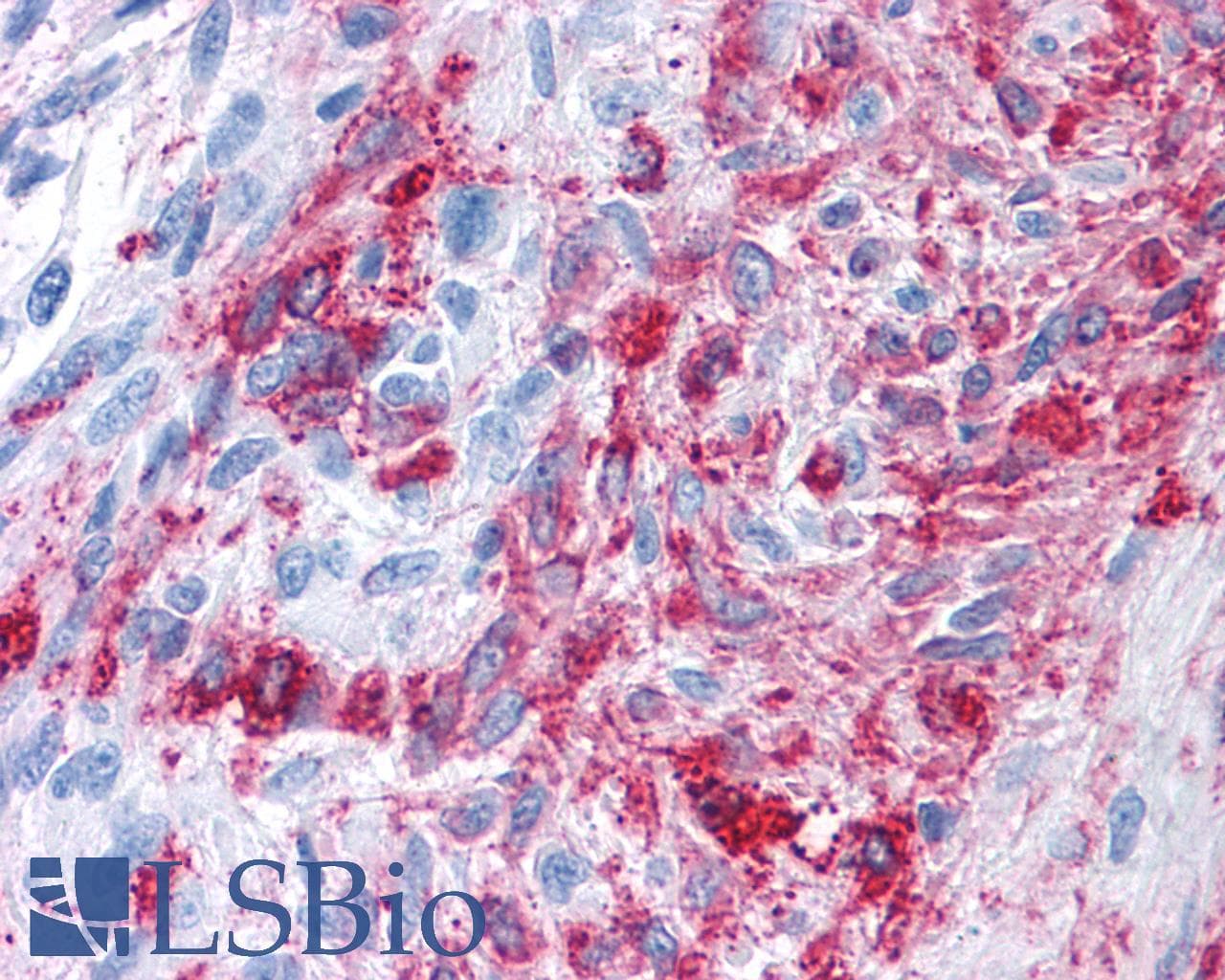 PathPlus™ Polyclonal Rabbit anti-Human FZD3 / Frizzled 3 Antibody (N-Terminus, IHC)