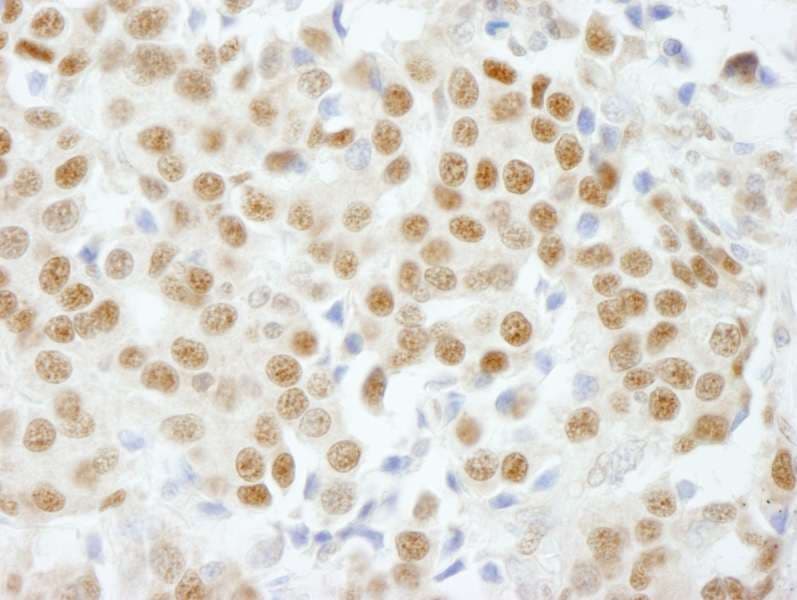 Polyclonal Rabbit anti-Human GTF3C5 Antibody (aa469-519, IHC)