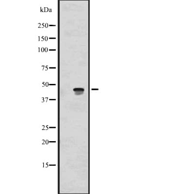 Polyclonal Rabbit anti-Human ALKBH5 Antibody (WB)