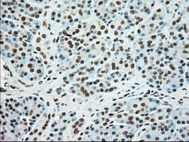 SSB / La Antibody (clone OTI2C8)