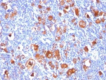 FSCN1 / Fascin Antibody (clone FSCN1/418)