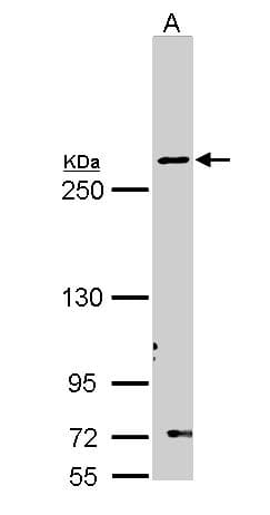 FASN / Fatty Acid Synthase Antibody (aa401-694)