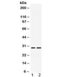 Polyclonal Rabbit anti-Human CA3 / Carbonic Anhydrase III Antibody (IHC, WB)