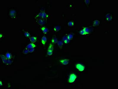 ABHD2 Antibody