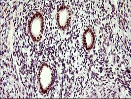 UPRT Antibody (clone OTI2D10)