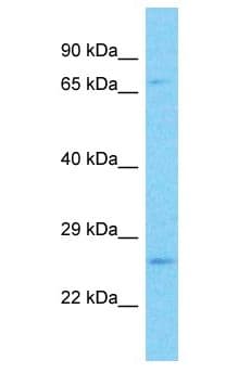 PGAM4 Antibody (aa138-187)
