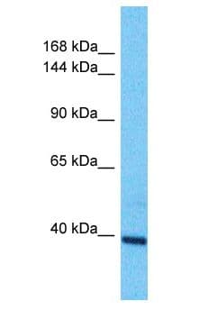 OTOGL Antibody (aa116-165)