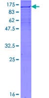 Human XRCC1 Protein (Recombinant GST)