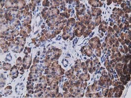 KCTD14 Antibody (clone OTI1D11)
