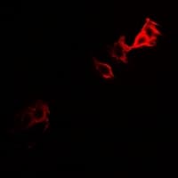 Polyclonal Rabbit anti-Human PGM1 / Phosphoglucomutase 1 Antibody (IF, WB)
