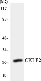 Polyclonal Rabbit anti-Human CMTM2 Antibody (aa164-213, WB)