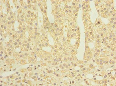 PROSC Antibody