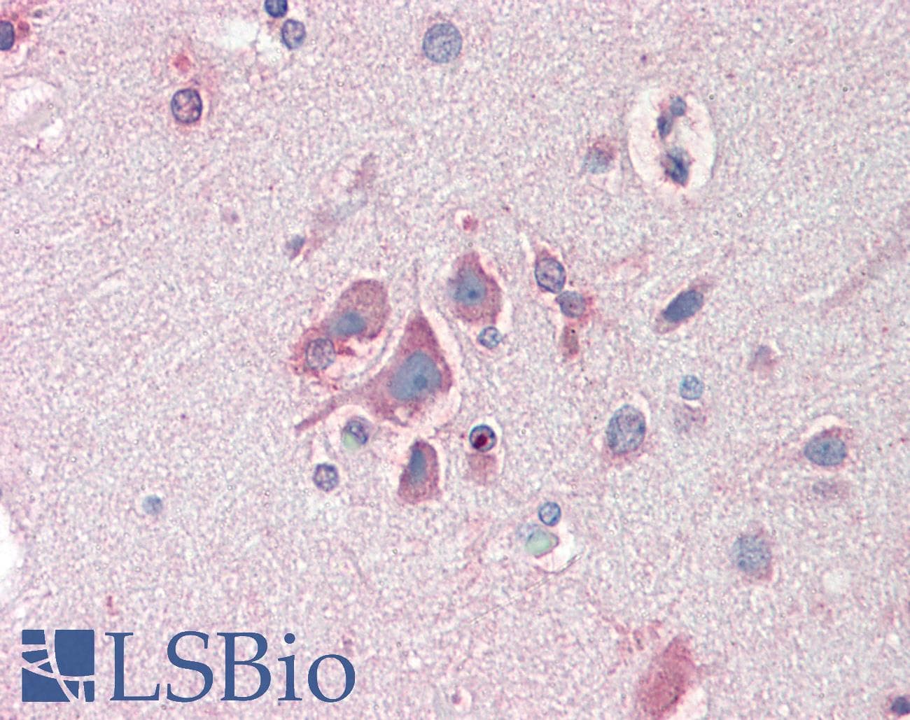 IHC-plus™ Polyclonal Goat anti-Human FBXL2 Antibody (aa2-14, IHC, WB)