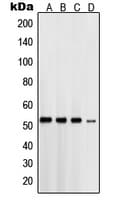 PSEN1 / Presenilin 1 Antibody (N-Terminus)