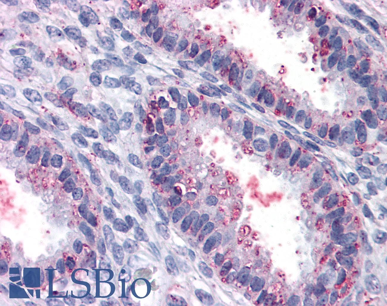 IHC-plus™ ENTPD2 Antibody (Internal)