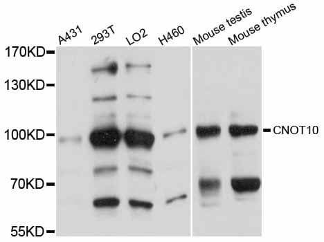 Polyclonal Rabbit anti-Human CNOT10 Antibody (WB)