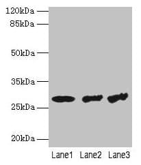 Polyclonal Rabbit anti-Human TBCB / CKAP1 Antibody (IHC, WB)