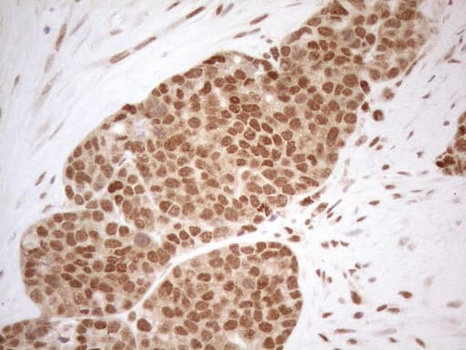 Monoclonal Mouse anti-Human RGL2 Antibody (clone OTI10F2, aa547-777, IHC, WB)