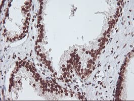 EXOSC7 Antibody (clone OTI1G8)