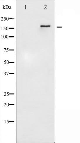 Polyclonal Rabbit anti-Human ERBB4 / HER4 Antibody (phospho-Tyr1284, IHC, IF, WB)