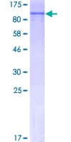 Human RARS Protein (Recombinant GST)