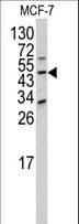 Polyclonal Rabbit anti-Human DXO / DOM3Z Antibody (aa73-99, WB)