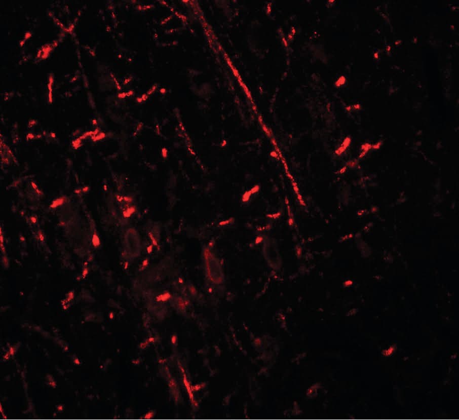 DDX41 / ABS Antibody